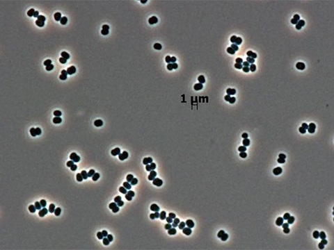 «Спящий агент»: как микроб сумел обмануть лаборатории NASA