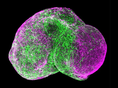 Пятилетние «мини-мозги» научились воспроизводить нейронные связи уровня детского возраста. Этические вопросы выходят на первый план
