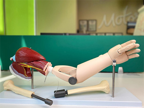 Государство оценило производителя бионических протезов «Моторика» более чем в 10 млрд рублей